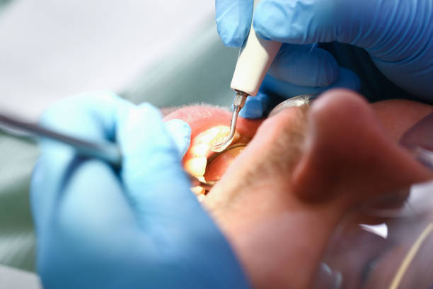 Best Emergency Root Canal Treatment in Raymond, WA