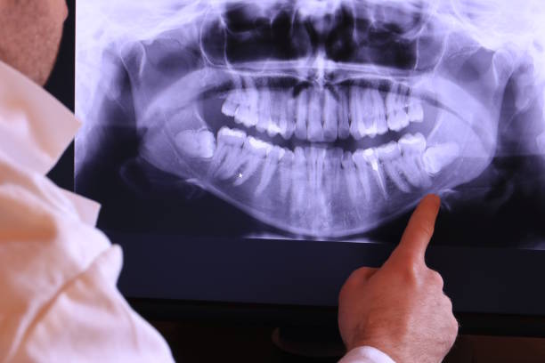 Best Broken or Cracked Tooth Emergency Dentist in Raymond, WA
