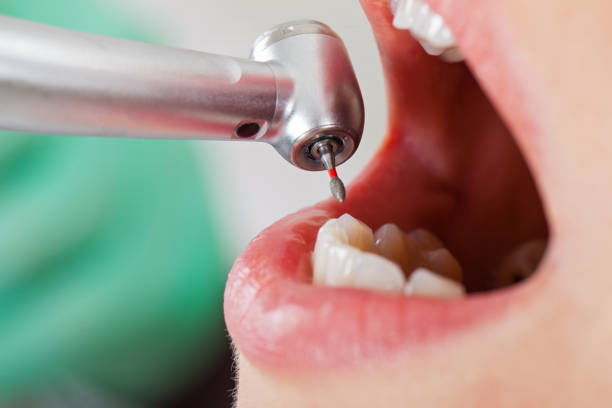 Best Emergency Dentist for Special Needs Patients in Raymond, WA